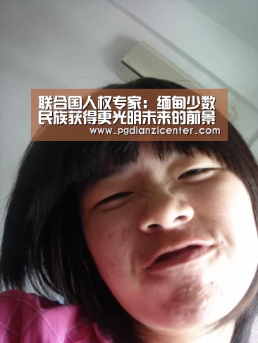 联合国人权专家:缅甸少数民族获得更光明未来的前景真实存在“pgdianzi”(图1) pg电子入口官网